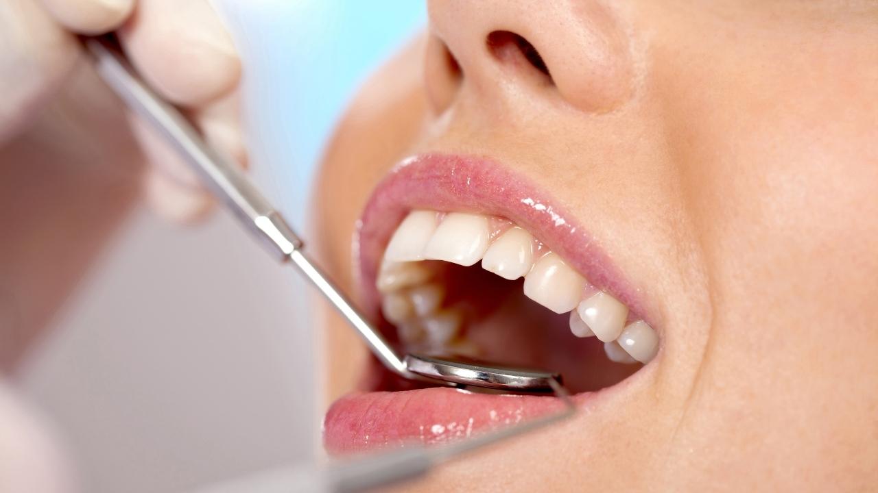 טיפולי שיניים בטורקיה
